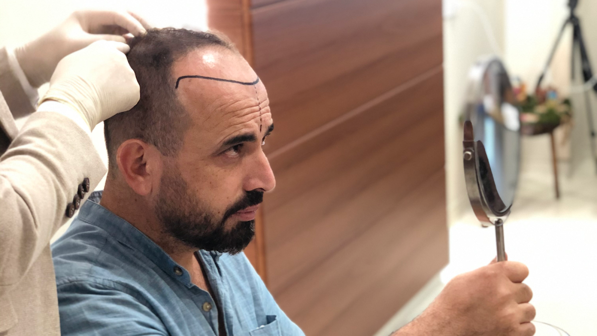 Techestetik Saç Ekim Merkezi - Hair Transplant Istanbul Logo