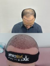Haircenter Saç Ekim Merkezi